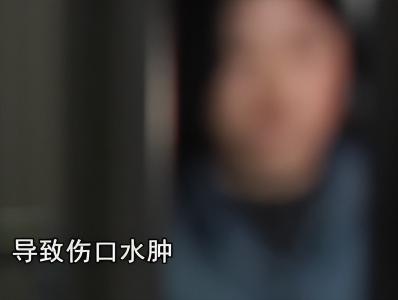 做一次心理检查多少钱（从2000元的切皮手术）