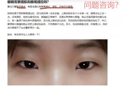 提肌双眼皮一般多少钱（小姑娘想做双眼皮不知道是否需要提肌和开眼角）