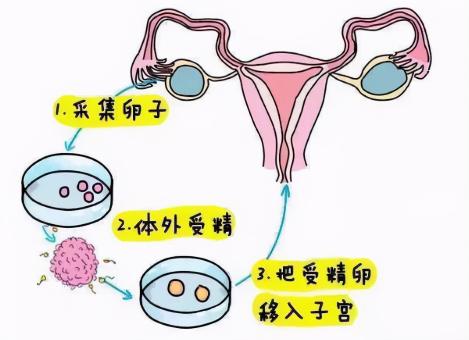 胚胎移植需要多少钱（试管胚胎移植是怎么移植的）