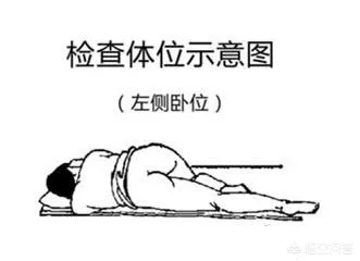 肛门镜怎么检查多少钱（肠镜检查）