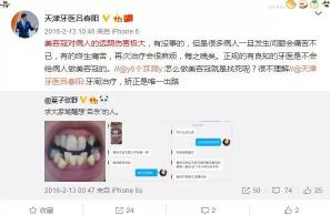 美容冠多少錢（為什么很多牙科醫(yī)生都在反對牙齒）