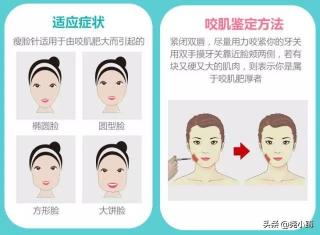 瘦脸打botox多少钱（悠兰科普七）