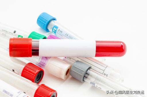 医院验尿酸多少钱一次（痛风患者没必要检查除尿酸外的项目）