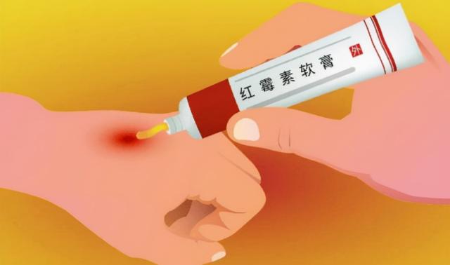 老专家药膏价格多少（2块钱的红霉素软膏被称为）