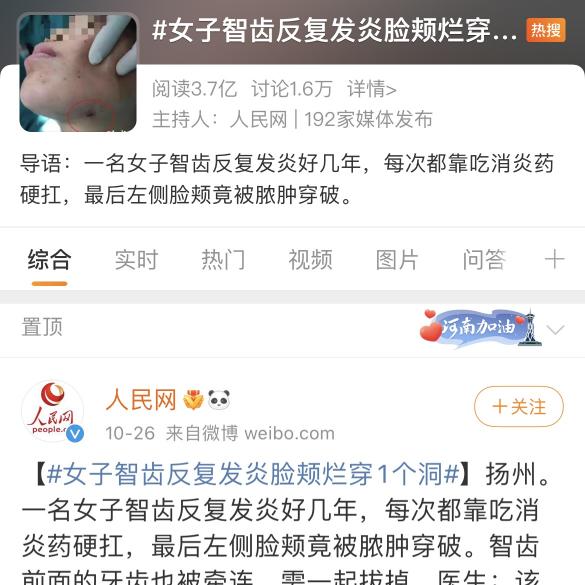 智齿补牙需要多少钱（女子智齿发炎）