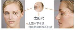 自体脂肪填充太阳穴多少钱（太阳穴填充）
