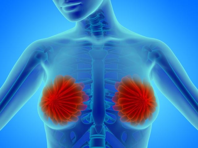 做乳腺彩超多少钱（乳腺彩超优缺点讲解）