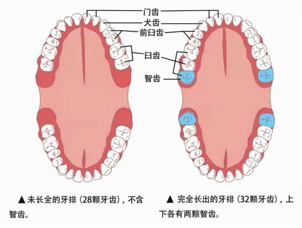拔牙大概要多少钱（智齿拔不拔）