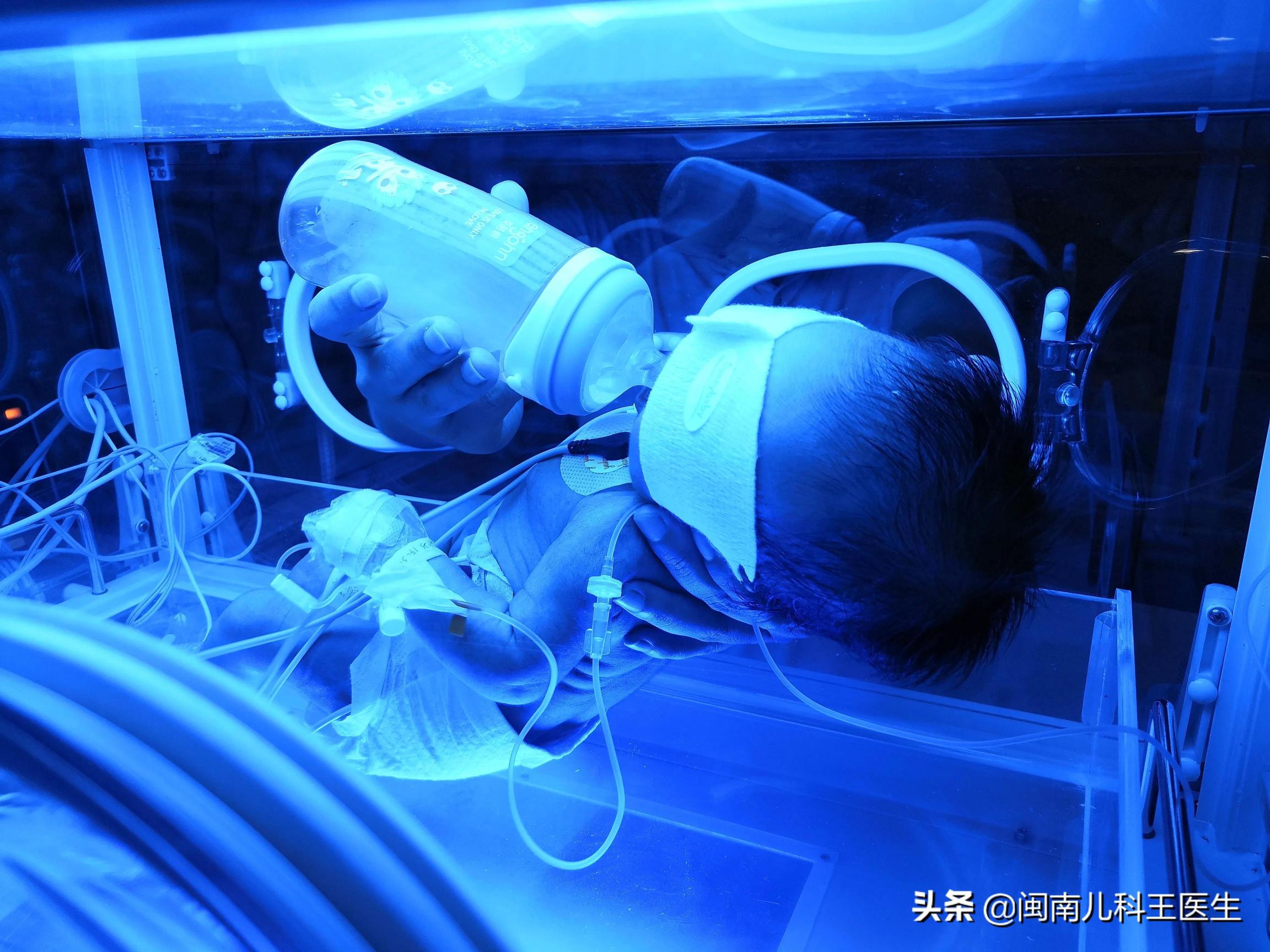 黃疸藍光多少錢（新寶媽誤區新生兒黃疸不用治療）