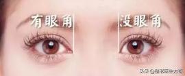 開個眼角要多少錢（變美小課堂）