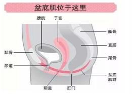 盆底肌修复大概多少钱（用1000元去医院做盆底肌修复比在家做瑜伽恢复快10000倍）