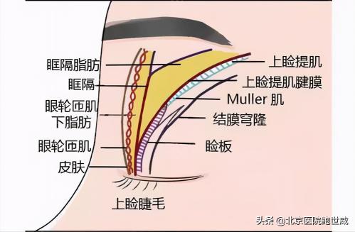 北京做个双眼皮多少钱（想做双眼皮）
