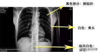 拍x光多少钱（在骨科）
