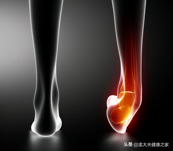 正红花油多少钱一瓶（红花油）
