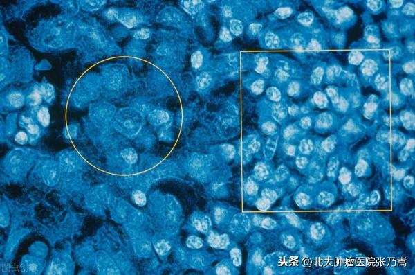 甲状腺手术大概多少钱（头颈外科的）
