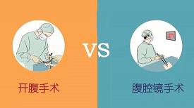 卵巢囊肿手术需要多少钱（话说卵巢囊肿）