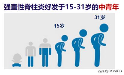 治疗强直需要花多少钱（协和医院曾小峰教授）