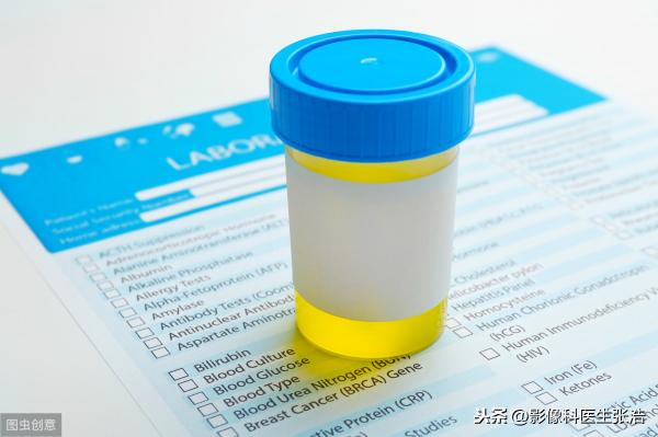 血尿常规多少钱（20元一次的尿常规）