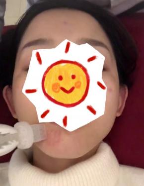 水光针多少钱一次（水光针走进高校医院）