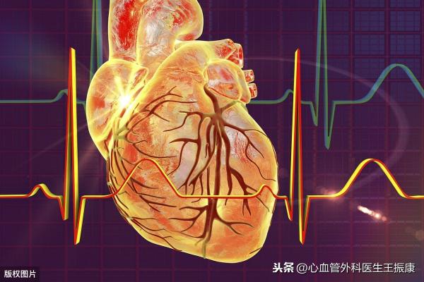 心脏彩超需要多少钱（心律失常该怎么办）