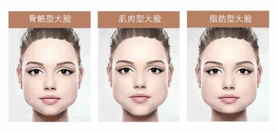 臉上吸脂需要多少錢（不想手術追求小臉美顏）