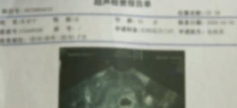 堕胎要多少钱（保胎不成）