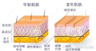 注射除皱一般多少钱（注射除皱和手术除皱）