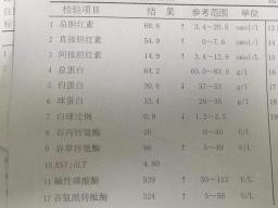 肝病检查需要多少钱（肝脏病有哪些检查项目）