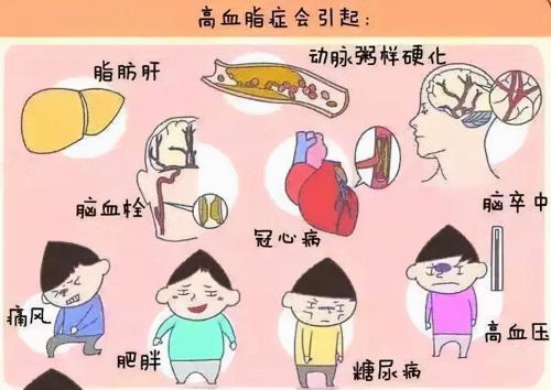 普罗布考片多少钱一盒（老年人使用他汀类药物要注意）