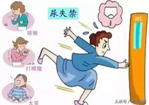 吊带手术一般多少钱（三成女性都会得的）
