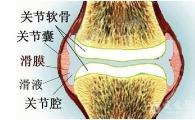 玻璃酸钠多少钱一针（膝关节炎打玻璃酸钠管不管用）