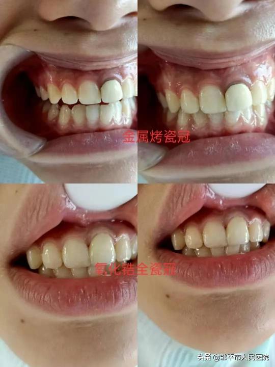 牙齿整形多少钱（口腔科）