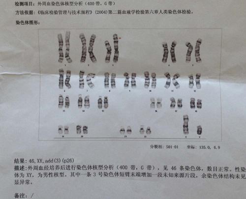 查怀孕要多少钱（怀孕了做染色体检查多少钱）