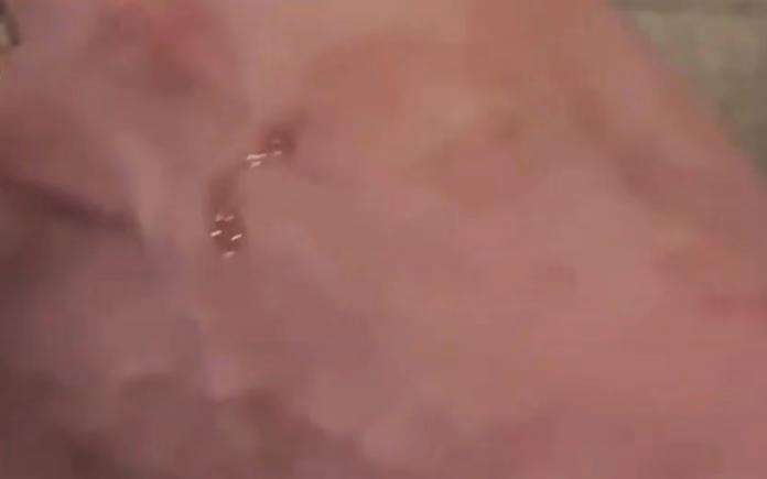 小白鼠血清多少钱一升（海南一男子被竹叶青咬伤）