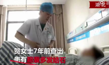 膽結石手術多少錢啊（女子手術取出7750顆膽結石）