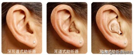 老人助听器大概多少钱（老人怎么选助听器）
