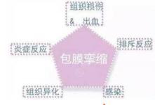 胸部假体取出需要多少钱（隆胸假体6年后假体要不要定期更换）