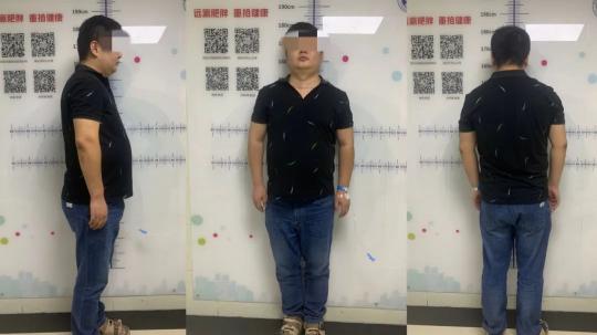 整容减肥多少钱（整容式）